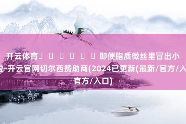 开云体育� � � � � �即便脂质微丝里冒出小颗粒-开云官网切尔西赞助商(2024已更新(最新/官方/入口)