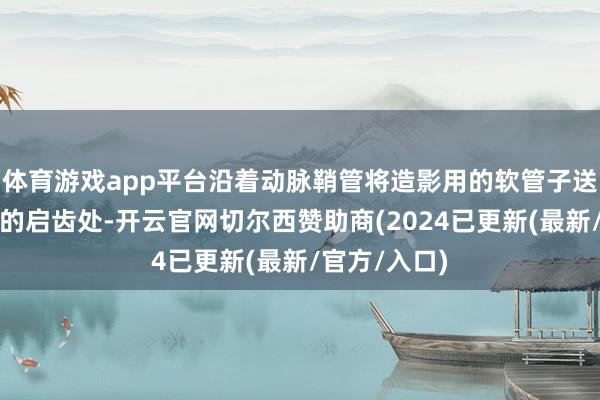 体育游戏app平台沿着动脉鞘管将造影用的软管子送到冠状动脉的启齿处-开云官网切尔西赞助商(2024已更新(最新/官方/入口)